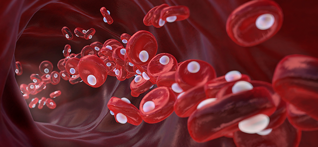 포톤테라피 사진