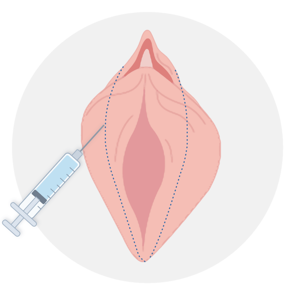 수술과정 STEP 2 마취